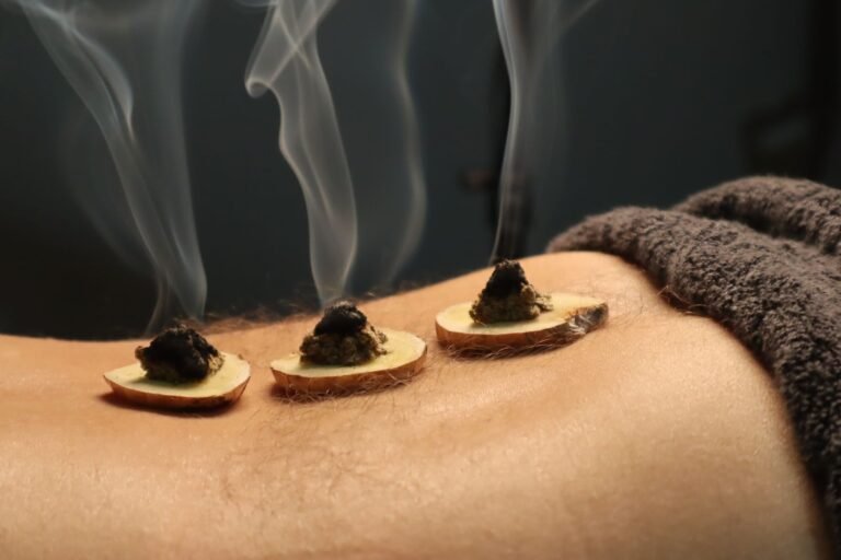 Close-up burning moxa cone - Agnikarma Ayurvedic Thermal Therapy Jaipur