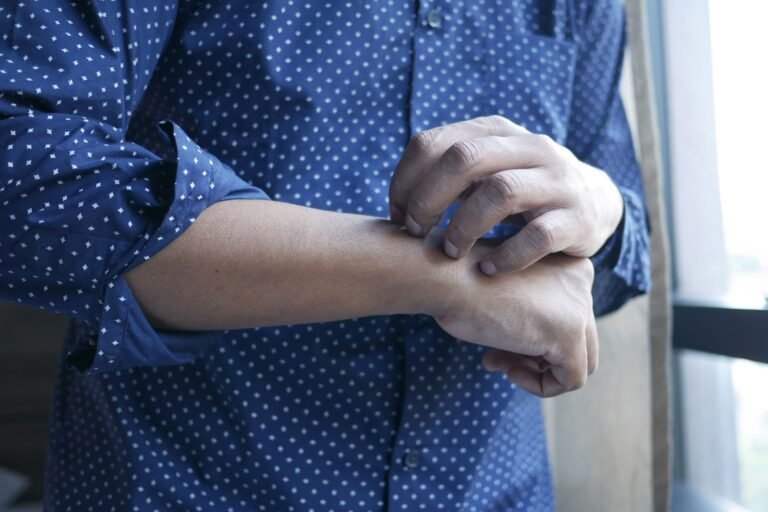 Skin allergy and Urticaria (Sheetpitta) Ayurvedic treatment in Jaipur