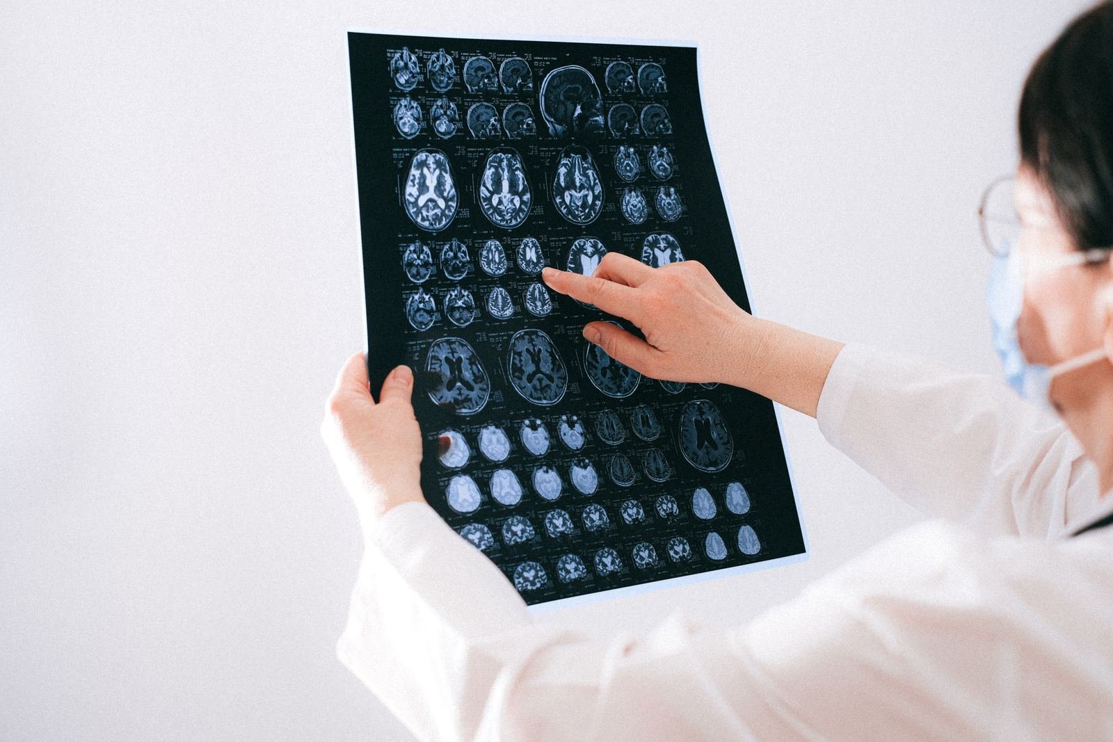 Doctor reviewing brain scan - Epilepsy Apasmara Ayurvedic Treatment in Jaipur